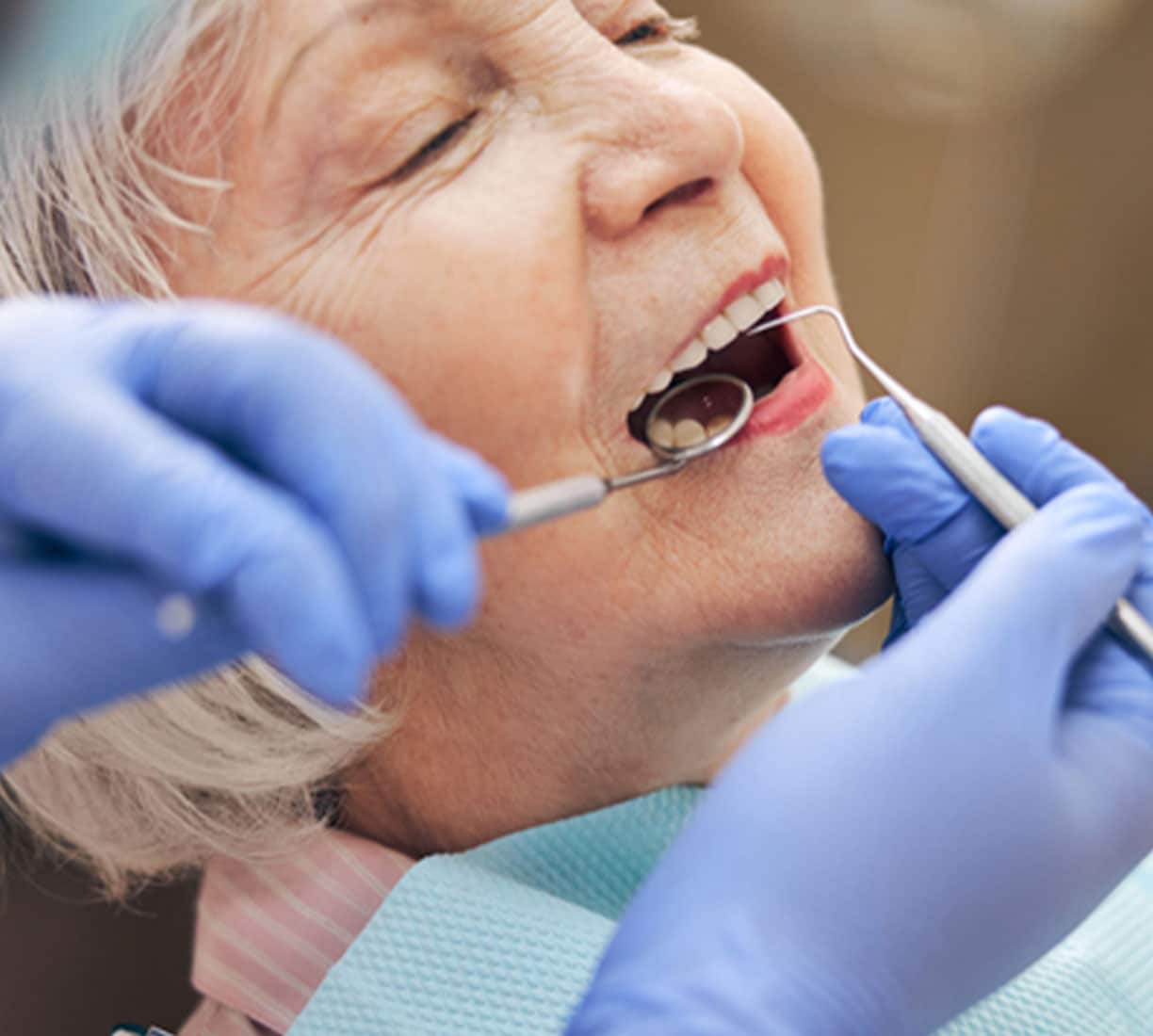 All-On-4 Dental Implants