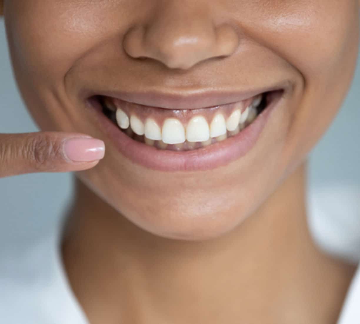 Dental Implants in Southfield, MI