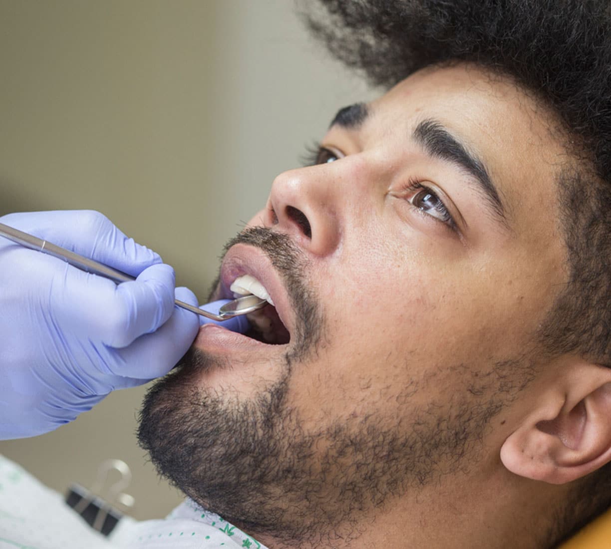 Pinhole Gum Surgery Southfield MI