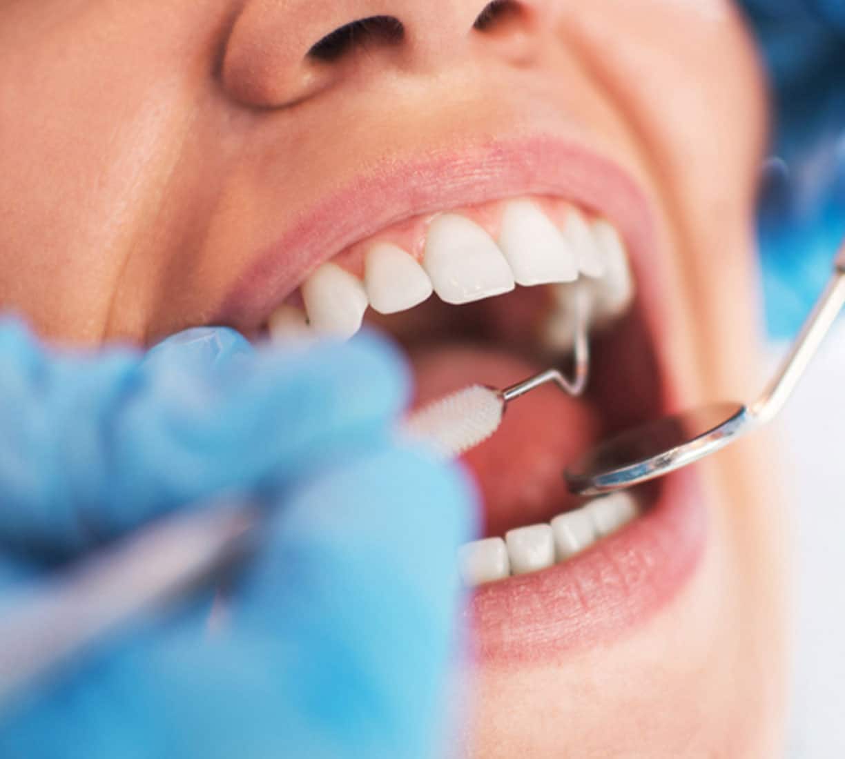 Oral Cancer Screening in Southfield, MI