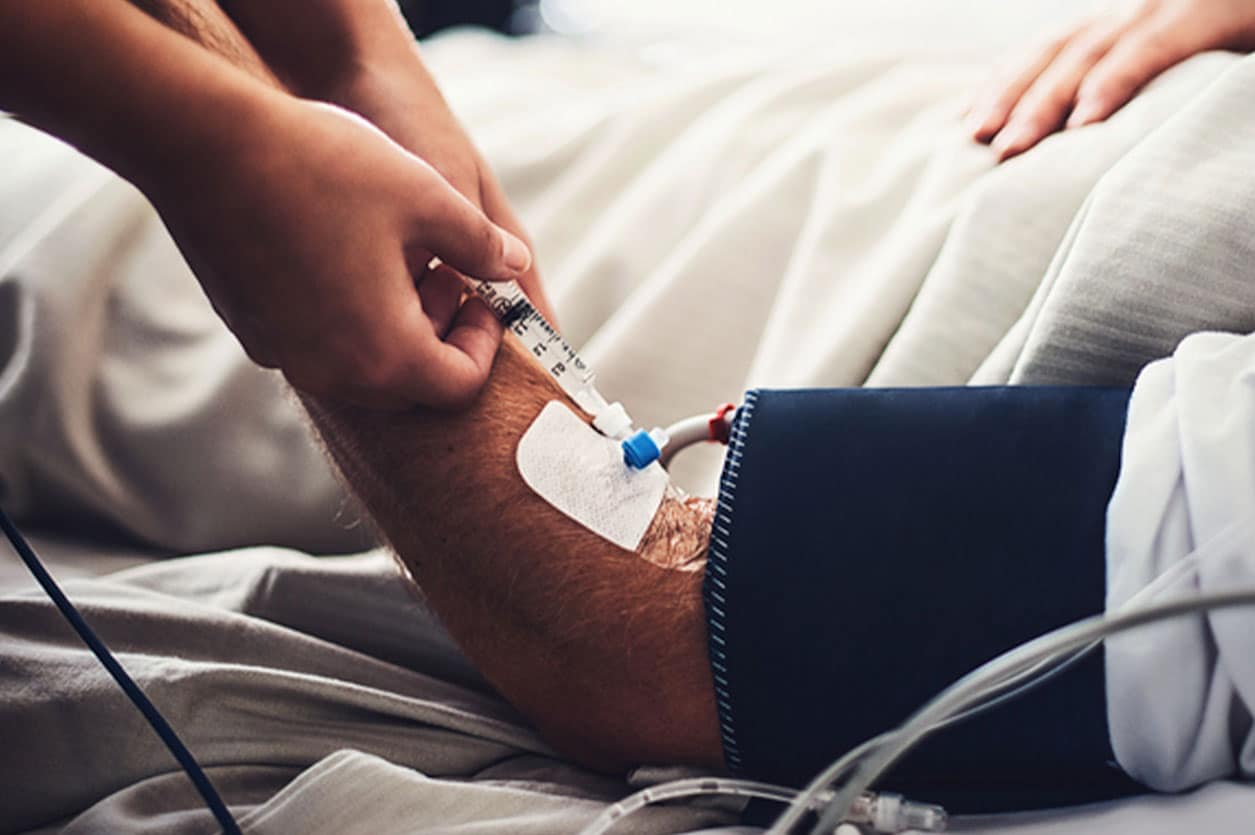 IV Sedation Dentistry