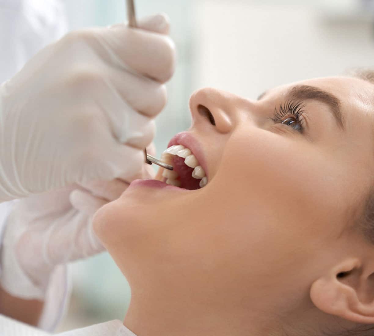 Tooth Extraction